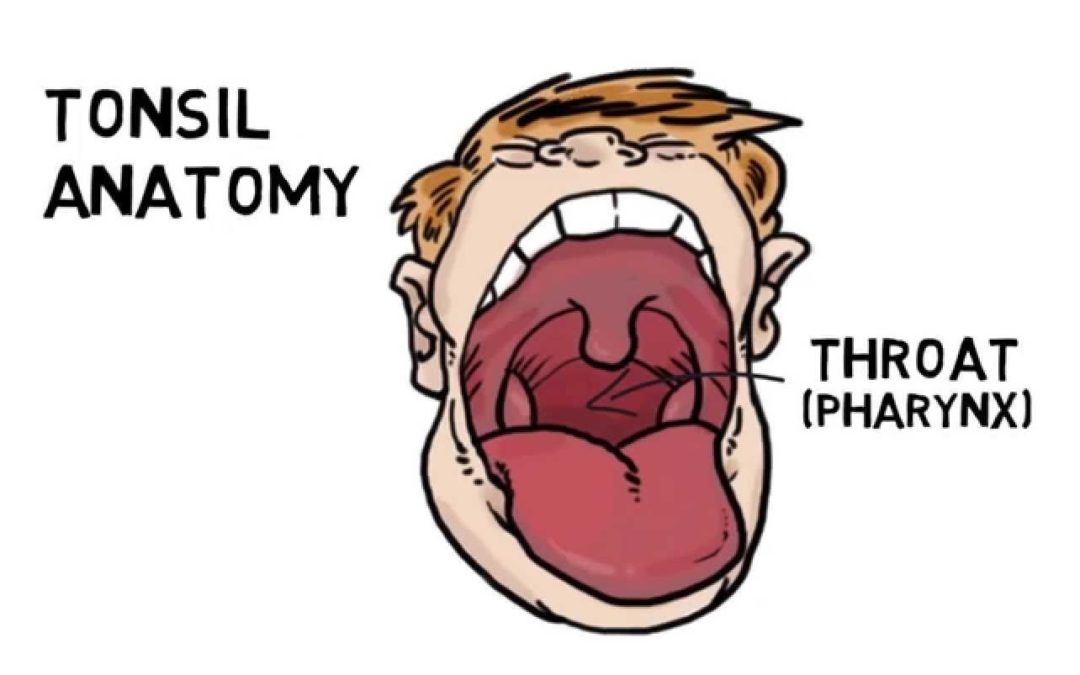 Don’t be a Tonsil